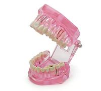 Modelo dental de reparación neural, tipodonto educativo fantoma dientes extraíbles anatómicos para la escuela de odontología, modelos transparentes para enseñar patología, material didáctico(pink)