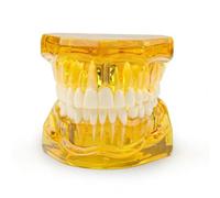 Modelo dental de reparación neural, tipodonto educativo fantoma dientes extraíbles anatómicos para la escuela de odontología, modelos transparentes para enseñar patología, material didáctico(yellow)