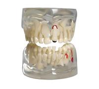 Modelo dental infantil transparente para demostración de dientes deciduos para enseñar la anatomía de los dientes primarios.