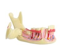Modelo dental para dentistas para demostración e ilustración