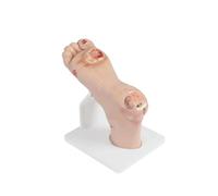 Modelo diabético del pie, simulador diabético graduado del pie con 1-3 leves o 4-5 lesiones severas, modelo purulento de la anatomía de la herida para el entrenamiento y la demostración