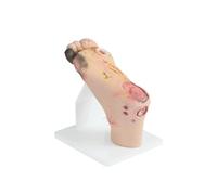 Modelo diabético del pie, simulador diabético graduado del pie con 1-3 leves o 4-5 lesiones severas, modelo purulento de la anatomía de la herida para el entrenamiento y la demostración