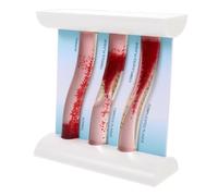 Modelo dinámico de anatomía vasos sanguíneos: progresión la aterosclerosis en 3 etapas con comparación del grosor vascular y placa