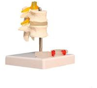 Modelo Educativo Cambios patológicos Modelo de demostración del Disco Lumbar Humano de la Columna Vertebral Lumbar
