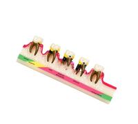 Modelo educativo de anatomía de periodontitis, modelo realista de patología periodontal de tamaño real, ayuda de enseñanza para clínica de demostración, herramienta de educación del paciente