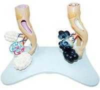 Modelo Educativo Modelo alveolar Alvéolos comparativos para Fumar y Modelos de Estudio de anatomía de alvéolos saludables Modelos de Modelos anatómicos de órganos Humanos