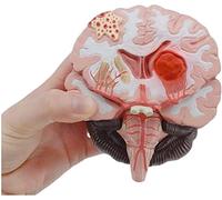 Modelo Educativo Modelo de Cerebro anatómico Modelo de Estructura patológica de Cerebro malformado Modelo de anatomía arteriovenosa de Materia Cerebral