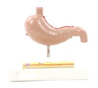 Modelo Gastrointestinal Patológico Lesiones Gástricas Humanas Ayudas de Enseñanza Modelo de Sistema Digestivo Herramienta de Enseñanza de Medicina