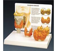 Modelo laríngeo Modelo de patología anatómica de tiroides humano Modelo Patologías normales y enfermedades Herramienta de recursos de enseñanza médica 14 * 5 * 9cm