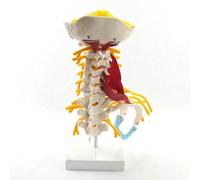 Modelo médico de columna cervical humana, espécimen óseo neuromuscular del plexo braquial