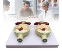 Modelo patológico de proteinuria, modelo didáctico biológico con base, modelo de glomérulo y nefrona renal para la comunicación médico-paciente.