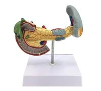 Modelo patológico del páncreas Modelo patológico del páncreas Duodeno y vesícula biliar Educación en fisiología Modelo anatómico de órganos Humanos for consultorios médicos y aulas