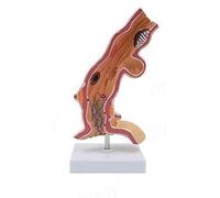 Modelo patológico esofágico humano, modelo de anatomía esofágica extraíble, modelo de sistema digestivo longitudinal de cáncer de esófago con aumento 5X, for demostraciones de enseñanza médica