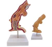 Modelo patológico esofágico, modelo de sistema digestivo longitudinal con soporte de exhibición, aumento 5X para demostraciones de enseñanza médica