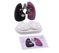 Modelo pulmonar anatómico humano, modelo de anatomía normal y patológico para la enseñanza clínica y el informe de conferencias Anatomía