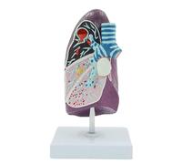 Modelo pulmonar patológico humano, desmontable, muestra pulmón del fumador, absceso, tuberculosis, neumonía y cáncer anatómico