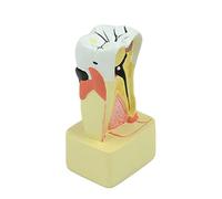 Modelo realista de análisis de patología, modelo de dientes para clínica, médico-paciente, comunicación, patología, diente para enseñar a niños, dentistas, educación del paciente, estudiantes