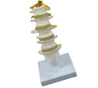 Modelo realista de anatomía de la columna lumbar que muestra discos intervertebrales y nervios espinales para demostración clínica, herramienta de enseñanza educativa