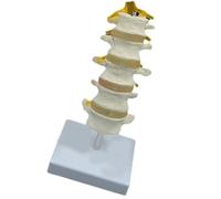 Modelo realista de anatomía de la columna lumbar que muestra discos intervertebrales y nervios espinales para demostración clínica, educación, anatomía de vértebras humanas
