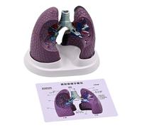 Modelo realista de anatomía pulmonar humana, herramienta de enseñanza anatómica, anatomía normal y patológica, modelo pulmonar para el aula