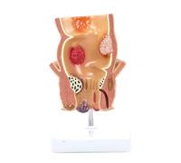 Modelo Rectal de demostración de Colon Modelo de enseñanza de anorrectal médico para Modelos médicos de enseñanza de la Escuela