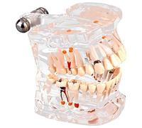 Modelos De Patología Oral Modelos Dentales Adecuados Para La Enseñanza Modelos De Comunicación Médico-Paciente