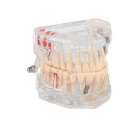 Modelos De Patología Oral Modelos Dentales Adecuados Para La Enseñanza Modelos De Comunicación Médico-Paciente