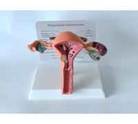 Modelos reproductivos femeninos Modelos de útero Material didáctico Patología ovárica ginecológica Modelo de anatomía de los órganos reproductores femeninos Modelo de útero, modelo anatómico de útero