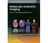 Molecular Anatomic Imaging: PET/CT, PET/MR and SPECT CT