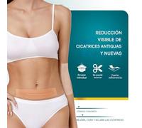Monozoz Cinta Para Cicatrices - 2 Rollos Parches Transpirables De Belleza Y Cuidado De La Piel | Tiras De Silicona Para Eliminar Cicatrices | Para Recuperación De Cesárea Abdominoplastía Hombro Brazo