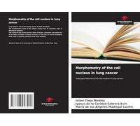 Morphometry of the cell nucleus in lung cancer: Histologic features of the cell nucleus in lung cancer
