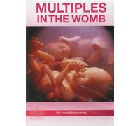 Multiples en el Vientre: El Viaje Increíble, DVD Guía de Embarazo Múltiple