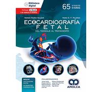 MUÑOZ ECOCARDIOGRAFIA FETAL