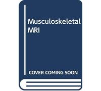 Musculoskeletal MRI