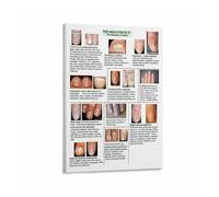 Nail Diseases Poster Nail Health Anatomy Chart Educational for Nail Technician Beauty Student Home Art(Framed,16X24inch(40X60cm))