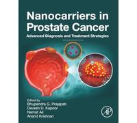 Nanocarriers in Prostate Cancer: Advanced Diagnosis and Treatment Strategies