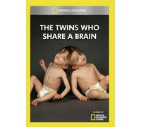 Twins Who Share A Brain [Edizione: Stati Uniti] [USA] [DVD]