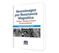 NEUROIMAGEN POR RESONANCIA MAGNETICA