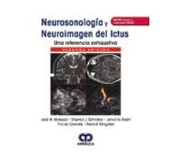 Neurosonología Y Neuroimagen Del Ictus. Una Referencia Exhaustiva + Ac