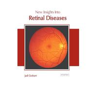 New Insights into Retinal Diseases