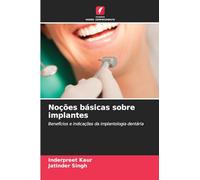 Noções básicas sobre implantes