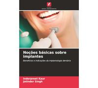 Noções básicas sobre implantes: Benefícios e indicações da implantologia dentária