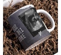 Nomart Taza Para el Día del Padre Con Ecografía, Taza Para Futuros Padres, Anunciar la Llegada del Bebé, Taza para el Futuro Papá, Padres Primerizos, Primer Día del Padre