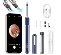Note5 Smart Visual - Kit de herramientas de eliminación de cera de oído con cámara 1080P, limpiador de oídos con modo de pinzas, 4 luces LED integradas, selector de cera de oídos con 12 puntas de púa,