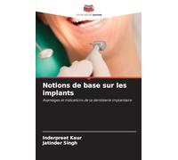 Notions de base sur les implants