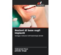 Nozioni di base sugli impianti