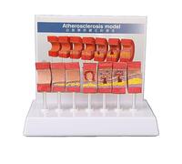 NSXAYIWE Modelo de anatomía Arterial de 7 Piezas, Modelo Vascular de Trombo de aterosclerosis Vascular para exhibición de Aprendizaje y educación