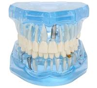 NSXAYIWE Modelo Tipodonto Oral Dental, Modelos Dentales Azules Acrílicos, Modelo De Boca Transparente, Modelo De Dientes Compatible Para Estudio Dental, Enseñanza, Investigación