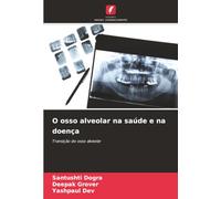 O osso alveolar na saúde e na doença: Transição do osso alveolar