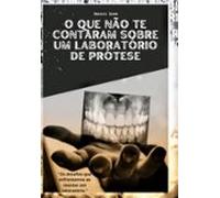 O Que Não Te Contaram Sobre Um Laboratório De Prótese (ebook)